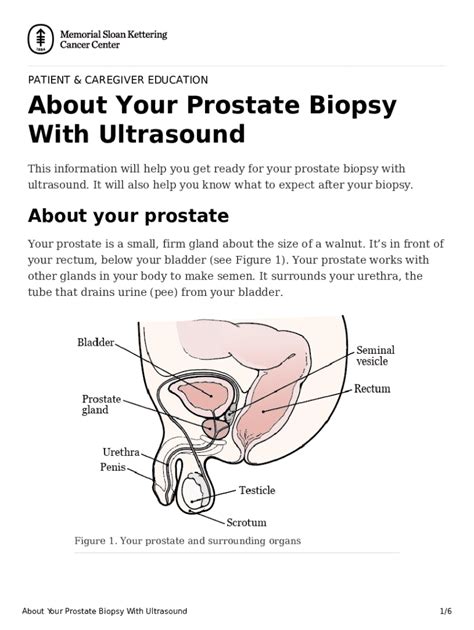 Fillable Online About Your Prostate Biopsy With Ultrasoundmemorial Sloan Fax Email Print