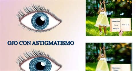 Oftalmolog A Obispado Monterrey Astigmatismo Qu Es El Astigmatismo