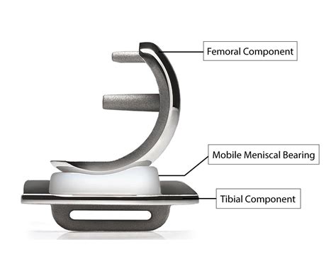 Partial Knee Replacement In Singapore Oxford Orthopaedics