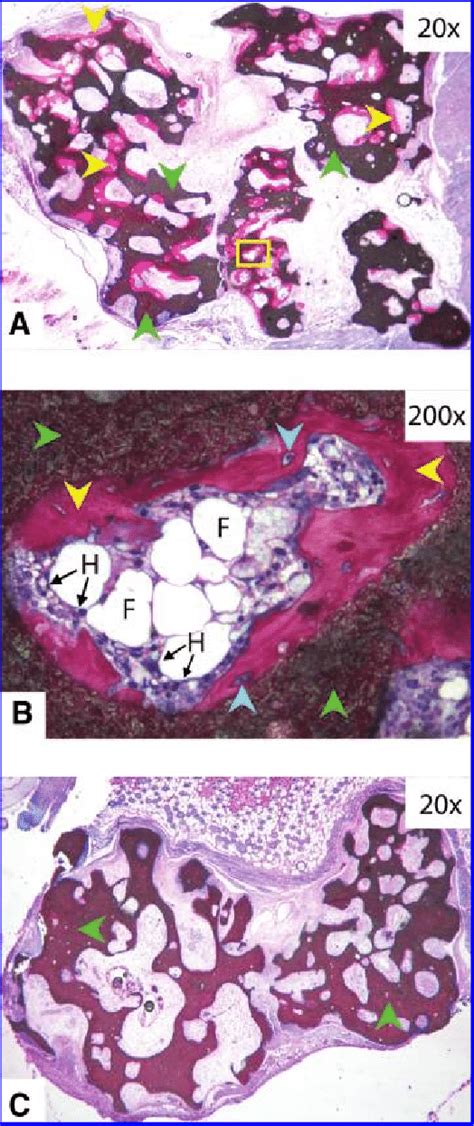 In Vivo Bone Formation Histological Section Of Bone Formation By