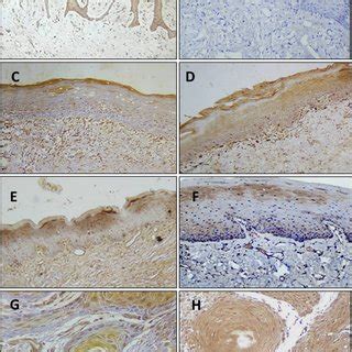 Immunohistochemical Expression Of Ctgf Around Blood Vessels A Nom B