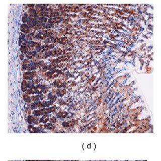 Immunohistochemical Evaluation Of Expression Of Hsp Protein