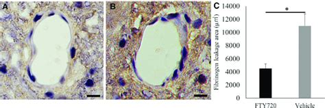 FTY720 Preserves Blood Brain Barrier Integrity Detection Of Fibrin