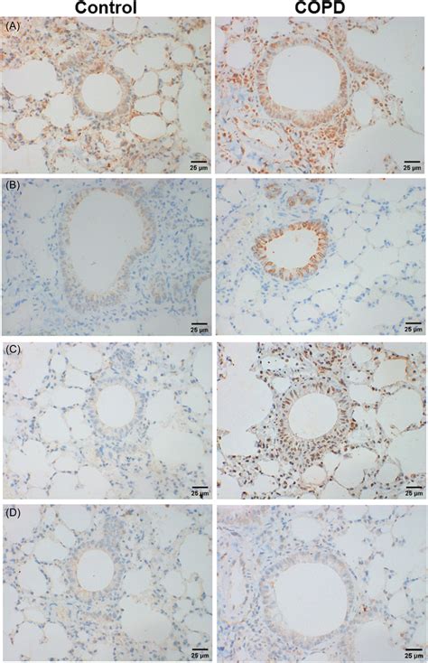 Immunohistochemistry Staining Of Ncr⁻ilc3 Related Cytokines In Lung