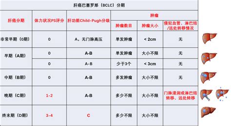 一文读懂肝癌的分期 知乎