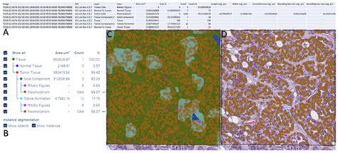 Diagnostics Free Full Text Comparative Evaluation Of Breast Ductal Carcinoma Grading A Deep