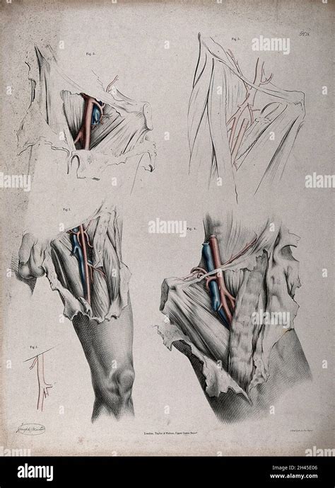 The Circulatory System Dissections Of The Groin And Thigh Of A Man