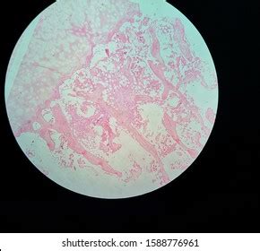 Human Spongy Bone Under Microscope Stock Photo 1588776961 | Shutterstock