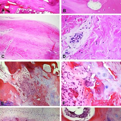 Representative Histological Sections For Degenerative Joint Disease Download Scientific Diagram