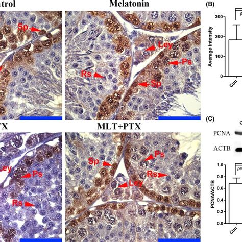 Expression Of PCNA In In Control And PTXtreated Mice Testes Testes