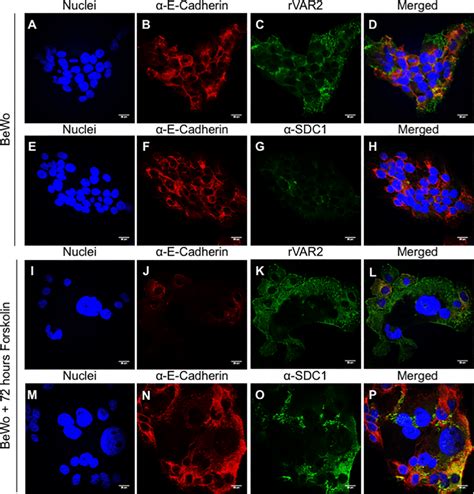 Expression Of Placental Cs And Sdc In Bewo Cells Before And After