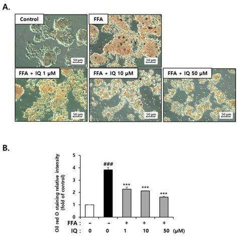 Effect Of Isoquercitrin On Free Fatty Acid Induced Lipid Accumulation