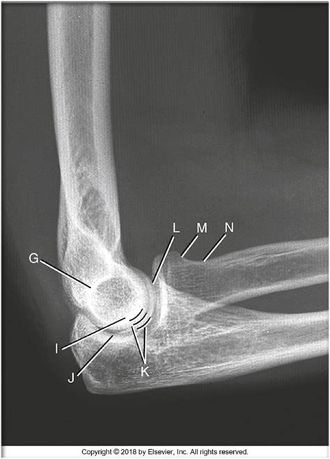 Lateral Elbow Diagram Quizlet
