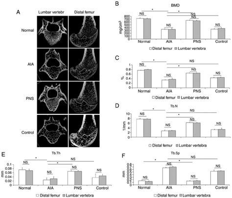 Micro Ct Analysis Of The Bmd Value Bone Structure And Quality Of The