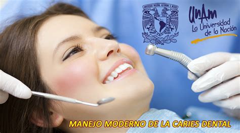 Manejo Moderno De La Caries Dental Curso Gratuito De La UNAM