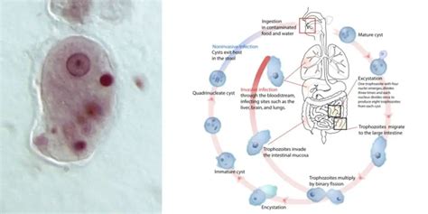 Entamoeba Histolytica Life Cycle Transmission Disease Diagnosis Treatment Biology Notes