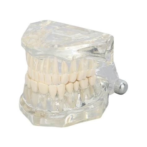 KIMISS Modèle de dents dentaires Modèle dentaire transparent modèle d