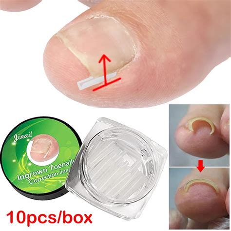 Set 10 Dụng Cụ Chỉnh Sửa Móng Chân Mọc Ngược Chuyên Nghiệp Shopee