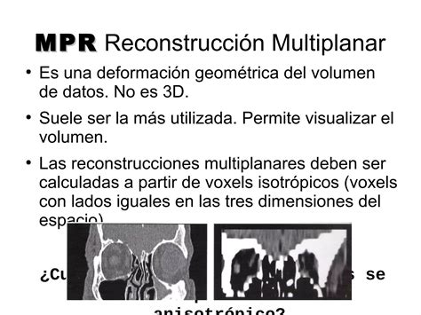 Reconstrucci N En Tc Ppt