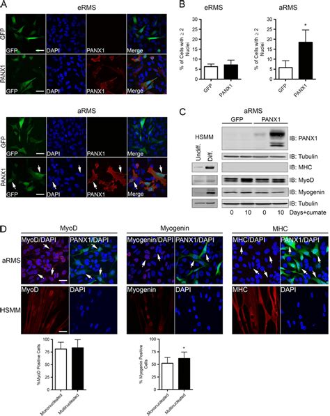 Panx Expression Does Not Trigger Rms Cell Terminal Differentiation A