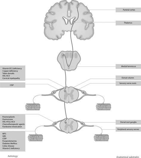 Clinical Assessment Of The Sensory Ataxias Diagnostic Algorithm With