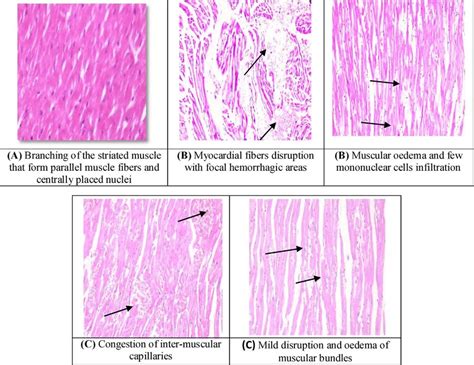 Photomicrograph Of Heart Section In Group I A Group Ii B And Group