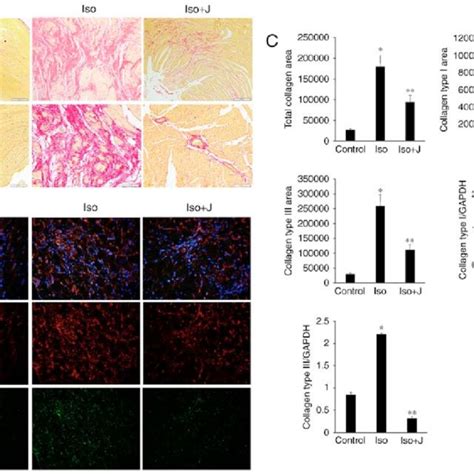 Qualitative And Quantitative Analysis Of Collagen Accumulation A