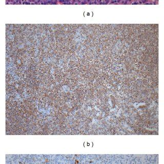 Histological And Immunohistochemical Analysis Of Posttransplant