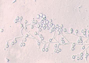 Yeast Identification Flashcards Quizlet