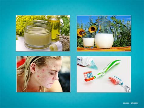 7 Home Remedies To Control Perioral Dermatitis | OnlyMyHealth