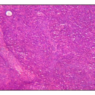 Histology of the omentum. (a) H&E ×100 magnification of omental tissue... | Download Scientific ...