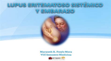 Pdf Lupus Eritematoso Sistemico Y Embarazo Pdfslide Net