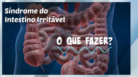 Sindrome Do Intestino Irrit Vel Youtube