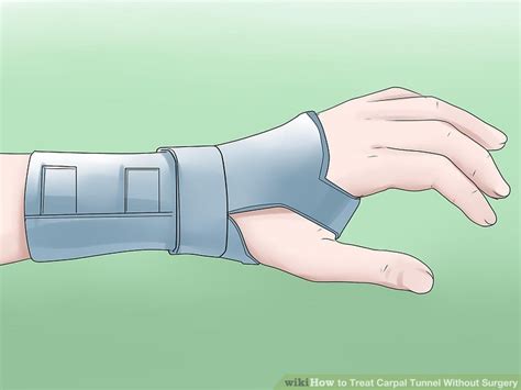 4 Ways To Treat Carpal Tunnel Without Surgery Wikihow