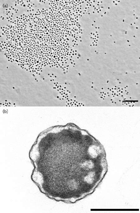 Phase Contrast Micrograph A And Thin Section Electron Micrograph B