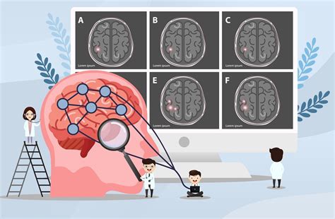 Complete Guide To Understanding Traumatic Brain Injury Claims