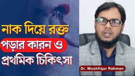 নাক দিয়ে রক্ত পড়ার চিকিৎসা Nose Bleeding Home Remedy নাক দিয়ে