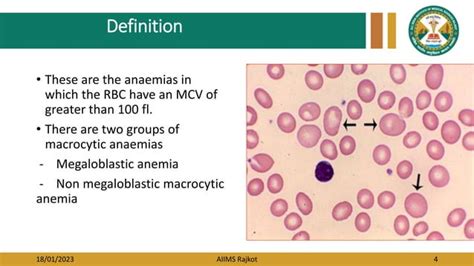 Macrocytic Anemia Pptx