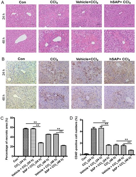 Protective Effect Of Human Serum Amyloid P On CCl4 Induced Acute Liver