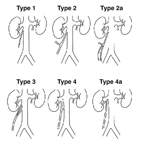 Spermatic Vein