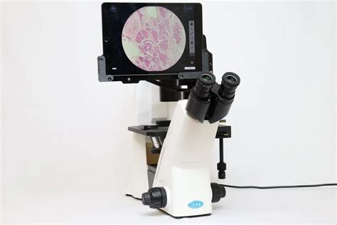 Inverted Microscope, LED, Model Name/Number: Cilika Bt-invi at best ...