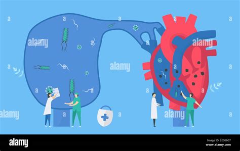 Cardiology Vector Illustration This Disease Calls Endocarditis It Is