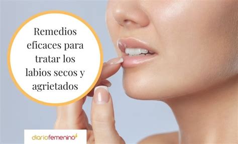 Labios Secos Y Agrietados Causas Y Remedios M S Efectivos