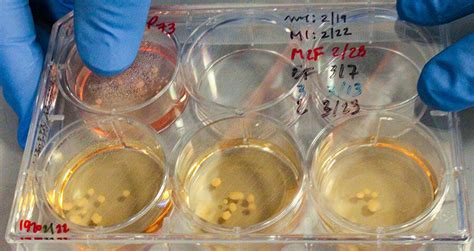 Scientists Grow Human-Neanderthal "Minibrains" In Petri Dishes