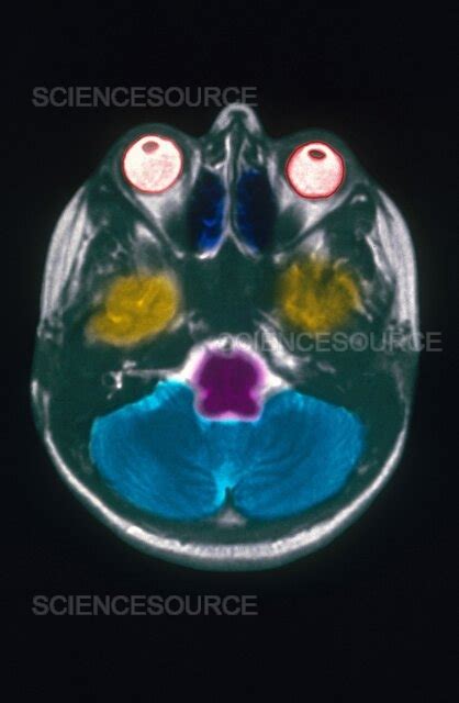 Photograph Mri Of Brain Science Source Images