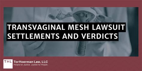 Vaginal Mesh Lawsuit Update [january 2025 Guide]