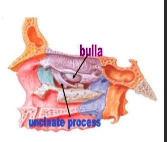 Rhinology And Paranasal Sinuses Flashcards Quizlet