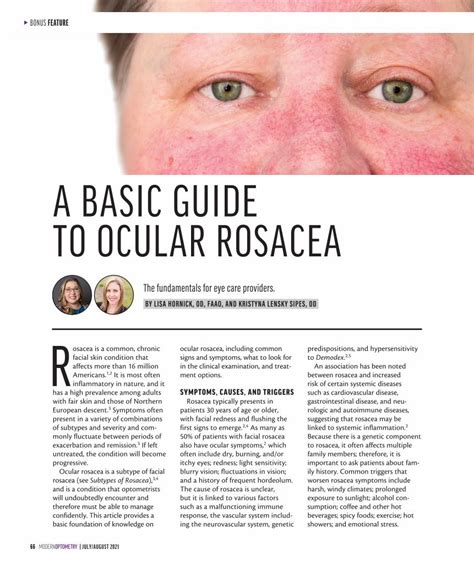 PDF A BASIC GUIDE TO OCULAR ROSACEA DOKUMEN TIPS