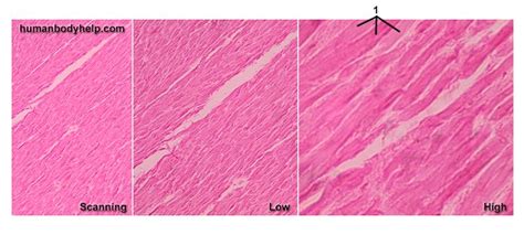 Elastic Tissue – Human Body Help