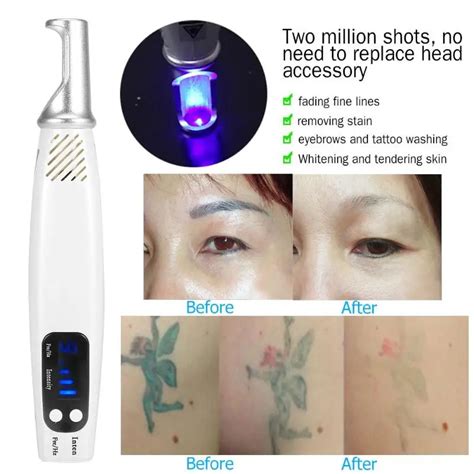 Pro Laser Picosecond Pen Blue Red Remove Tattoo Laser Pen Freckle Acne